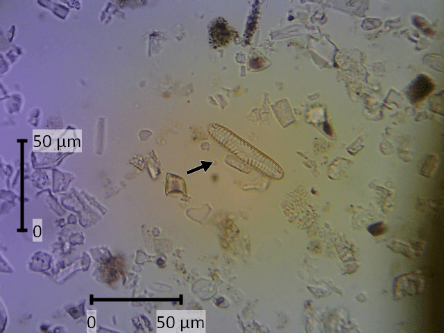Gambar 2. Diatom diantara fitolit dari sedimen Situs Gua Kidang, Blora dengan perbesaran 400x). (Dok. HIMA/M. Dziyaul F. Arrozain)